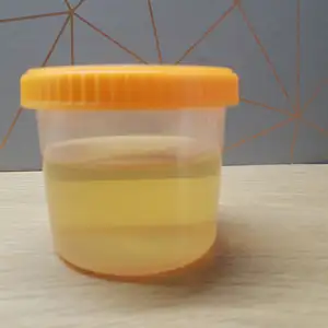 Piss