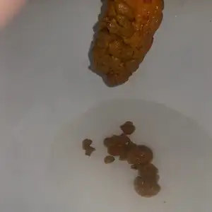 Scat tydzień - moje wszystkie kupki z zeszłego tygodnia