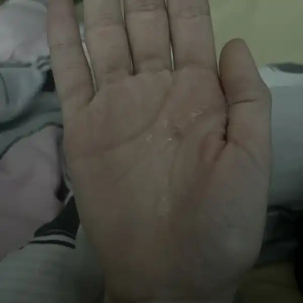 Slina