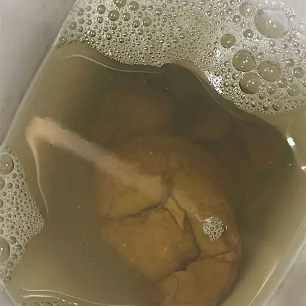 badanie moczu / kału